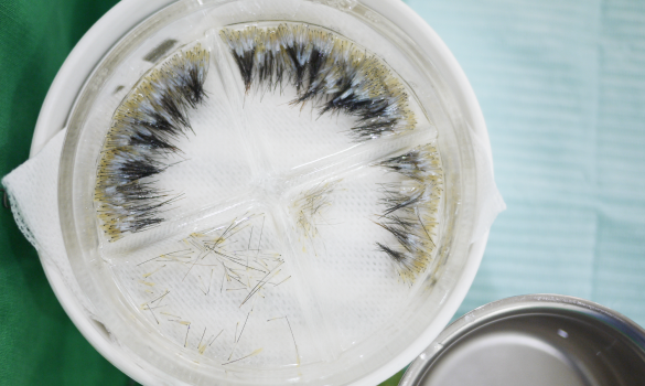 与器官移植手术相同的手术环境