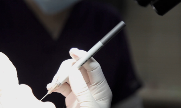 微创毛发移植，头皮损伤最小