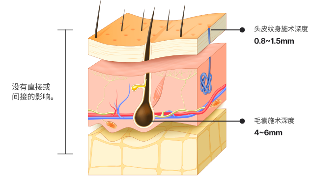 施术后，会对头皮和毛囊造成伤害吗？