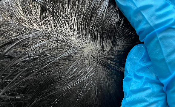 头皮纹身与普通纹身不同