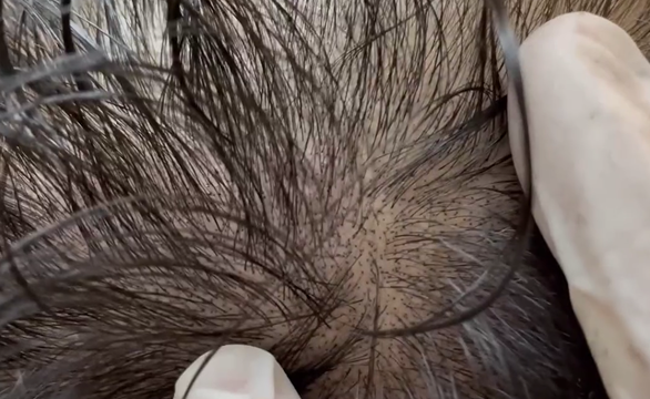 头皮纹身与普通纹身不同