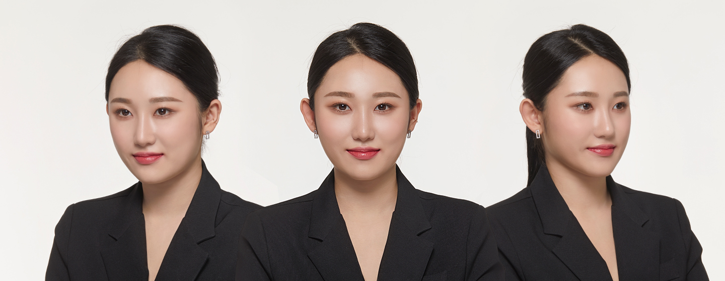 塑造平衡的小脸额头缩小和发际线矫正