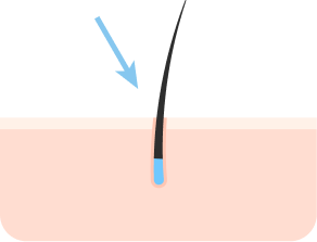 减少疤痕,干净的结果