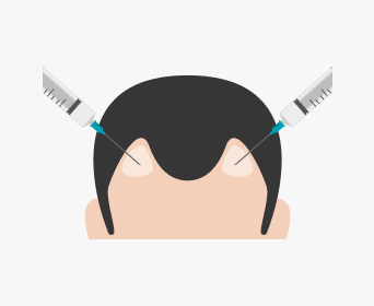 절개 헤어라인교정