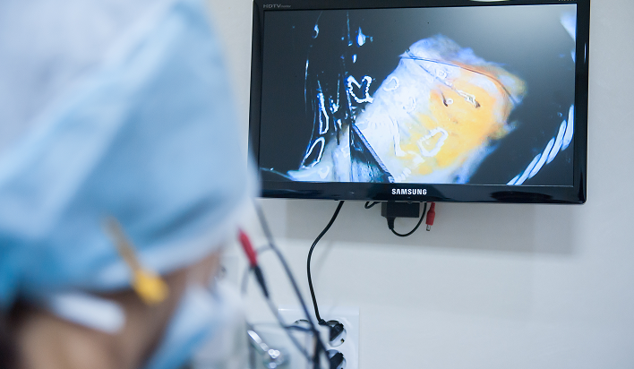 高倍数码显微镜（毛囊）分离