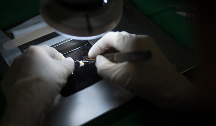 移植毛囊水中分离