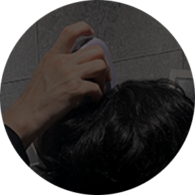 treatment-examination.根据脱发类型量身定制的注射治疗