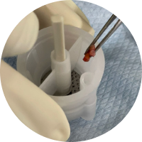 treatment-examination